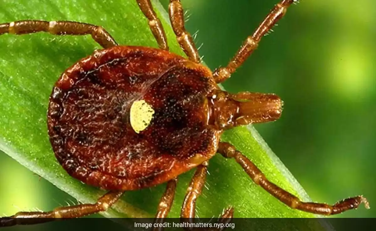 Alpha-Gal Syndrome: Increase in Meat Allergy Cases Linked to Tick Bites Sparks US Concern
