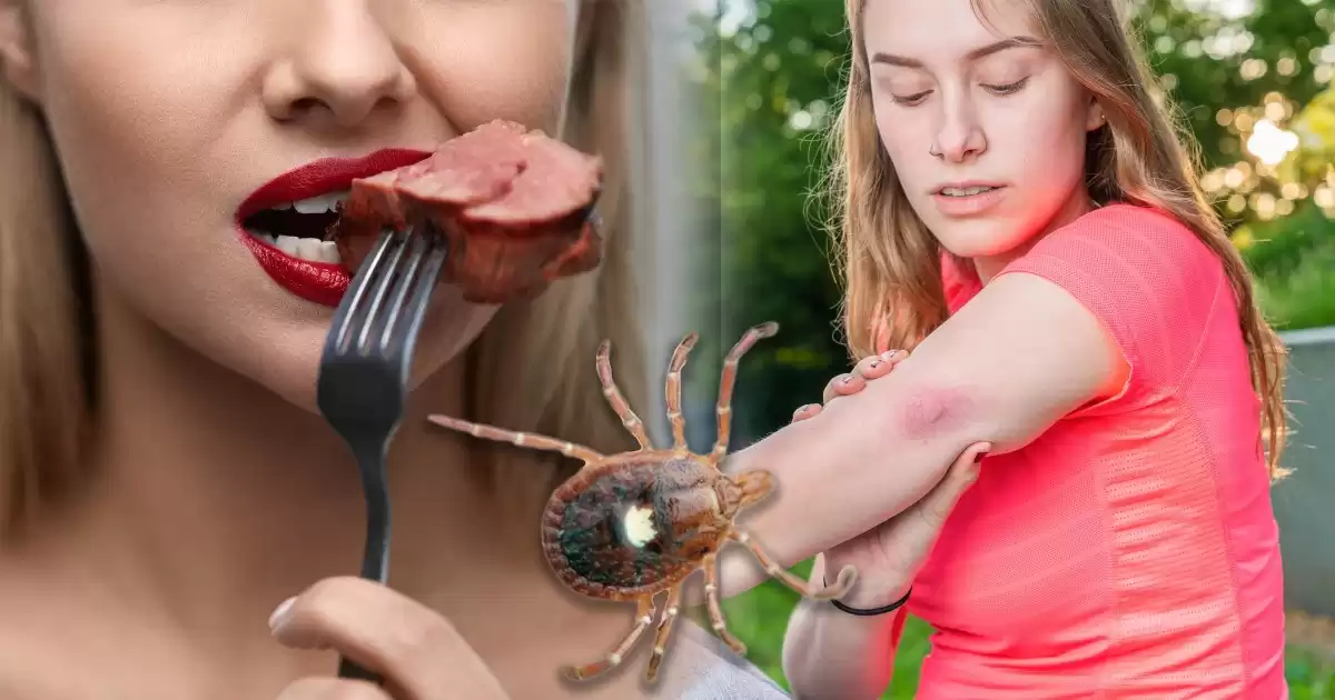 'Alarming Rise: Tick Bites Spreading Alpha-Gal Syndrome, Affects up to 450,000 in US with Meat Allergies'