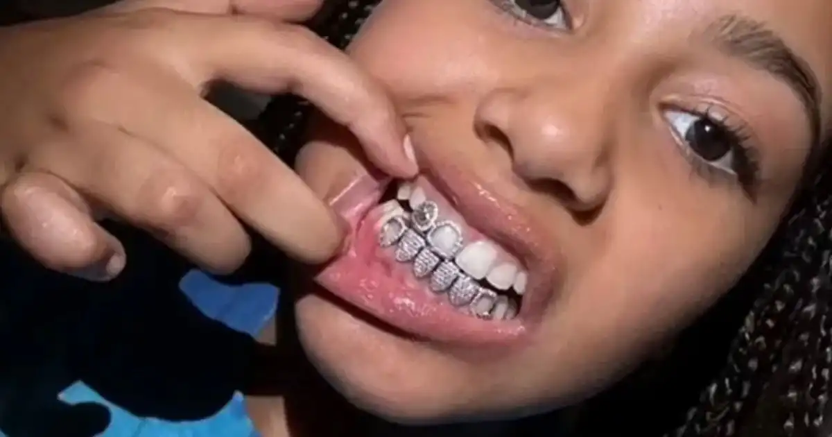 Kanye West daughter North diamond grill rapper dental work
