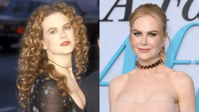 Nicole Kidman Addresses Plastic Surgery Rumors: 'I Didn't Like How My Face Looked'